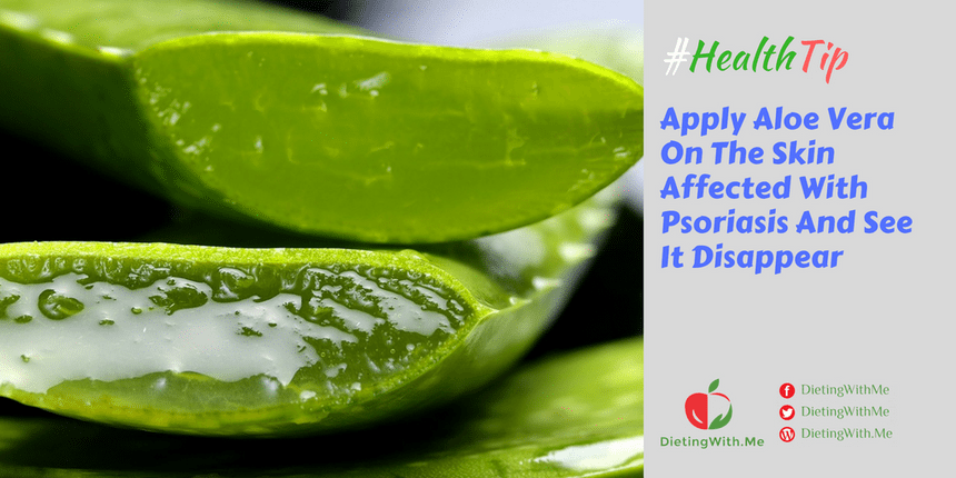 Apply Aloe Vera On The Skin Affected With Psoriasis And See It Disappear